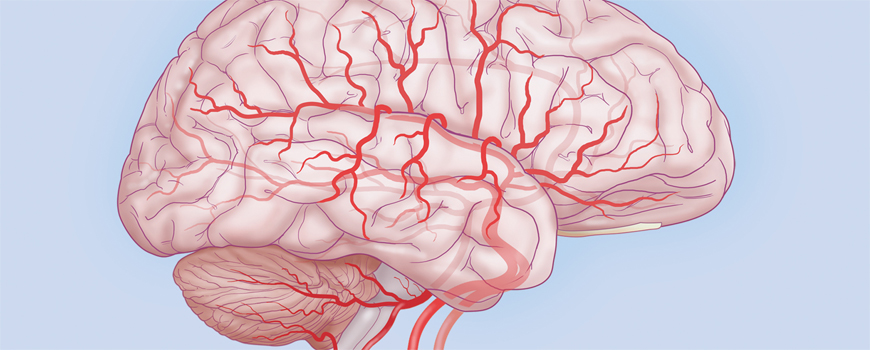 Cerebralni protok krvi kod atrijalne fibrilacije