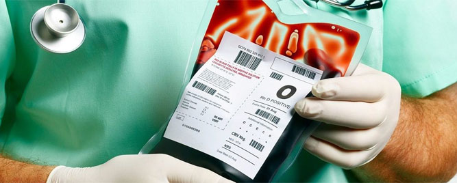Umerena anemija prilikom otpusta iz bolnice – kakve su dugoročne posledice?