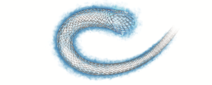 DARE studija: lečenje in-stent restenoze