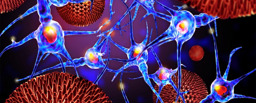 Psorijaza i aneurizma abdominalne aorte