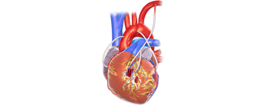 CABG: graft a.radialis vs. graft v.saphenae