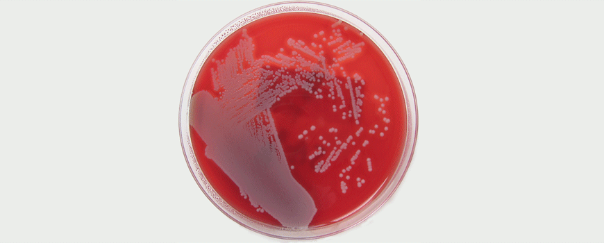 Dodati antibiotike lečenju apscesa: da ili ne?