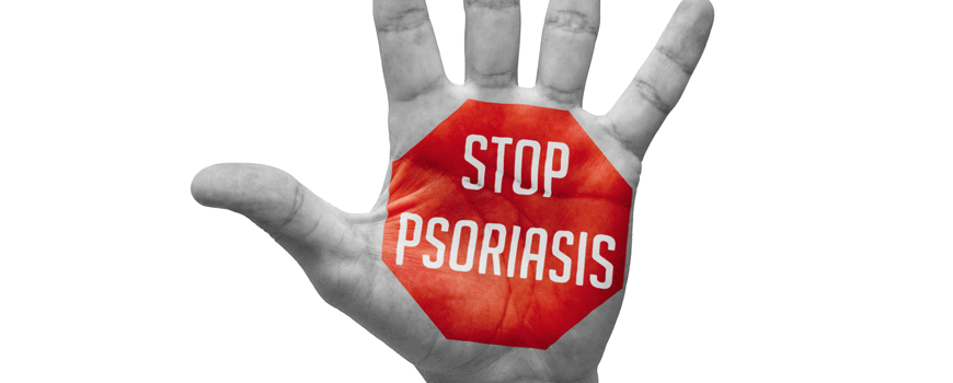 Tofacitinib kod hronične plak psorijaze