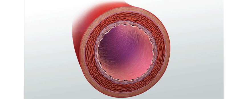 Graftovi kod CABG: a. radialis vs. SVG