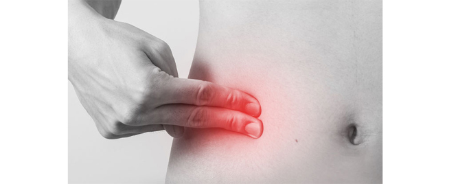 Lečenje apendicitisa: antibiotici vs. apendektomija?