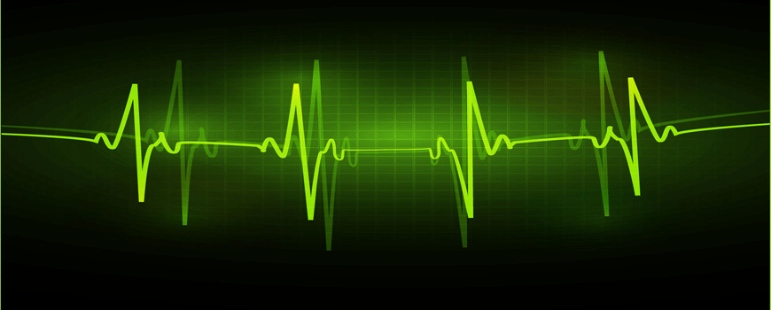 EKG monitoring kod pacijenata sa moždanim udarom