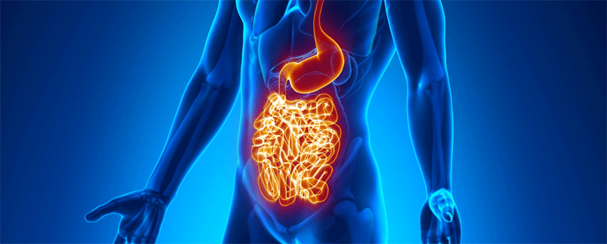 Infliximab vs. hirurgija kod terminalnog ileitisa u sklopu Kronove bolesti