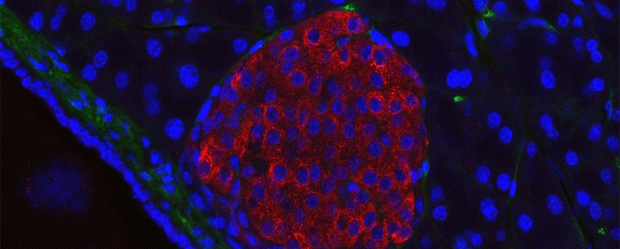 Intraabdominalna transplantacija pankreasnih insulocita