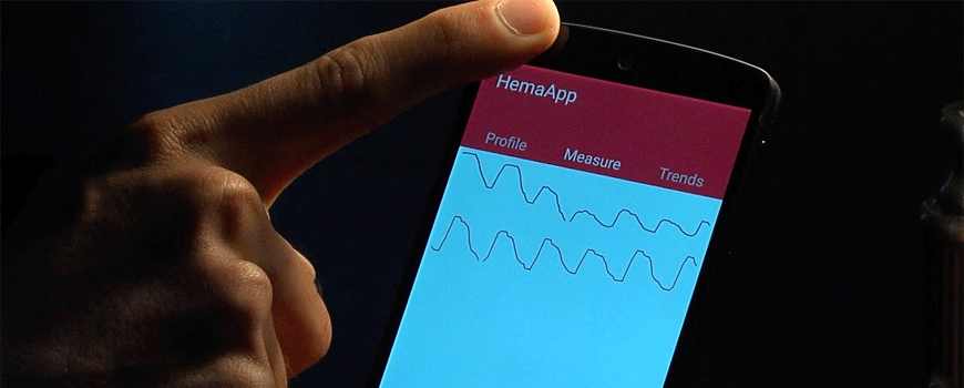 Smartphone aplikacija za merenje hemoglobina u krvi