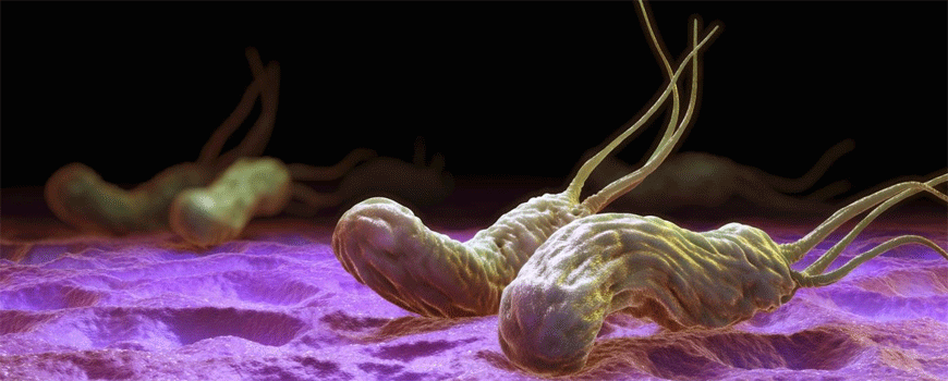 Različilti pristupi lečenju Helicobacter pylori infekcije