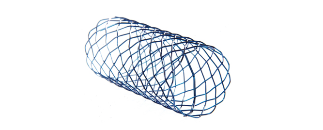 Smart stent tehnologija