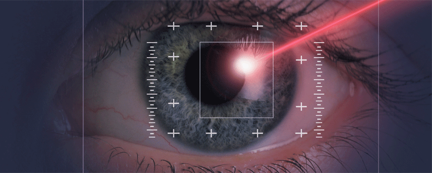 Kako pacijenti vide svoju lasersku korekciju dioptrije?