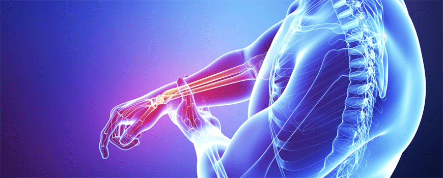 Denosumab u terapiji reumatoidnog artritisa