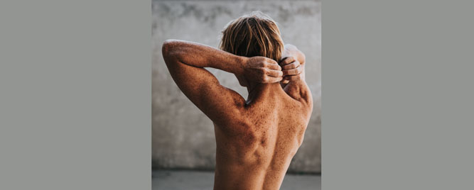 Rizik od ponovnog melanoma