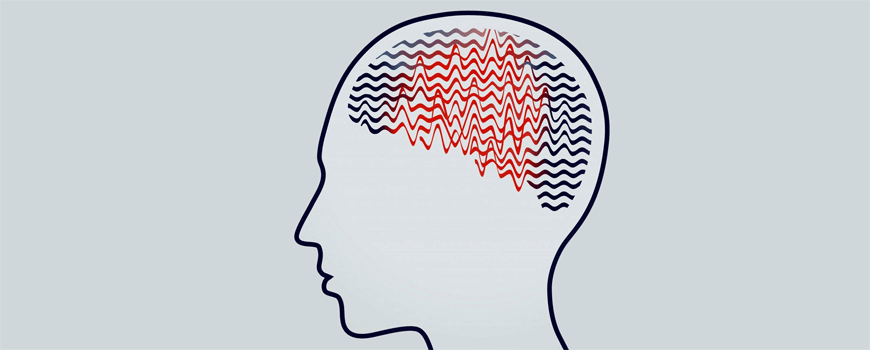 Prognoza pacijenata sa novodijagnostikovanom epilepsijom