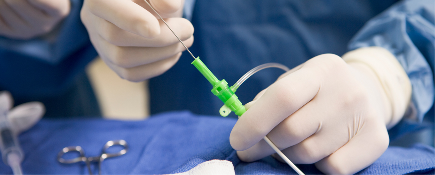 Transradijalni vs. transfermoralni PCI pristup