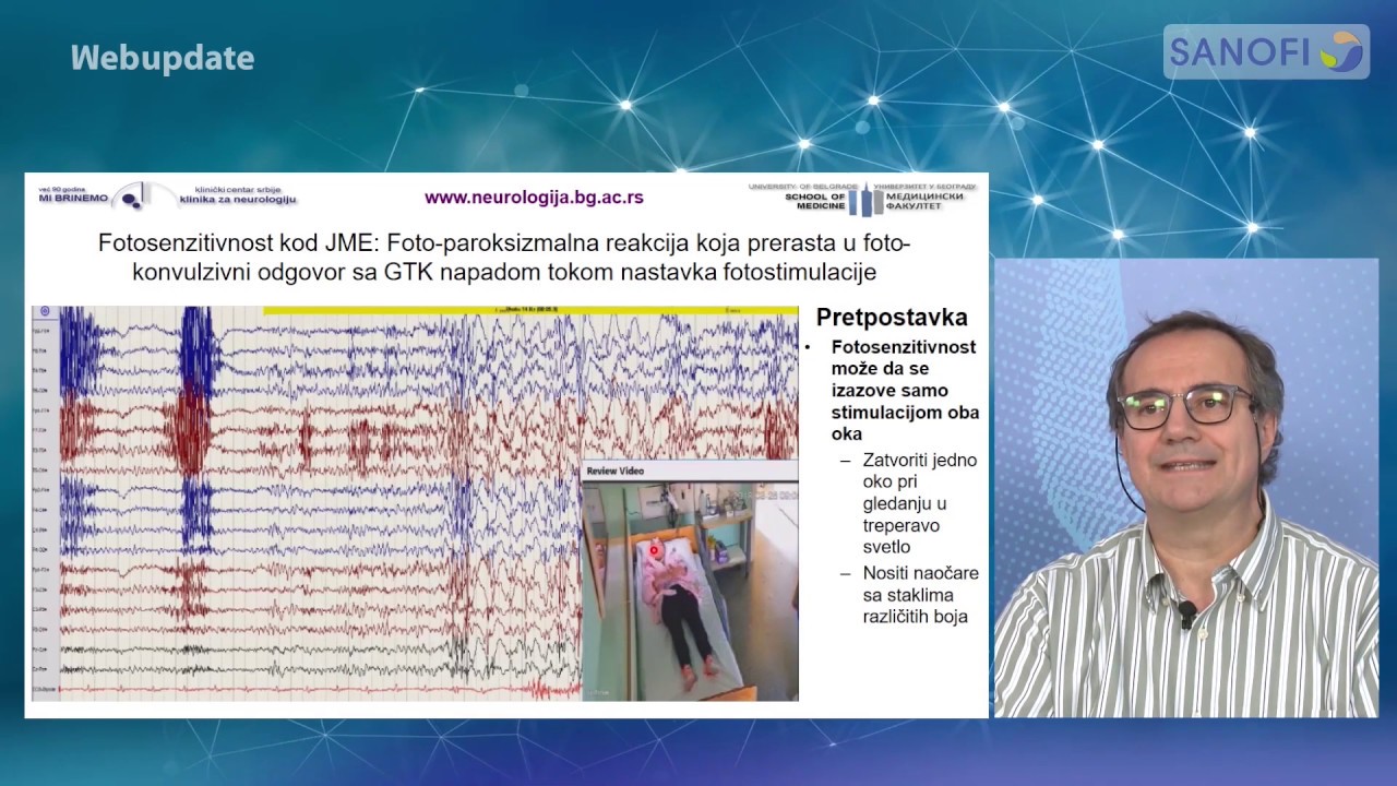 Klinički pristup idiopatskim generalizovanim epilepsijama