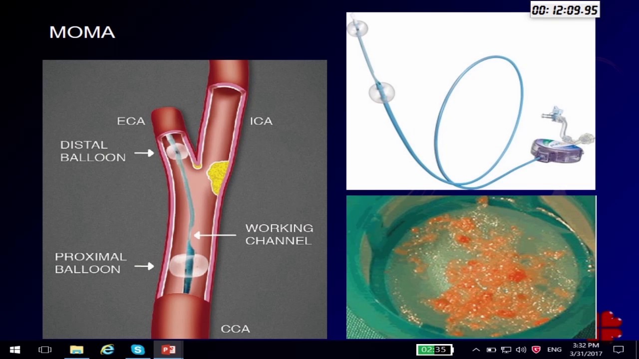 AMEC 2017 - RADIONICA ZA PERIFERNU ARTERIJSKU BOLEST