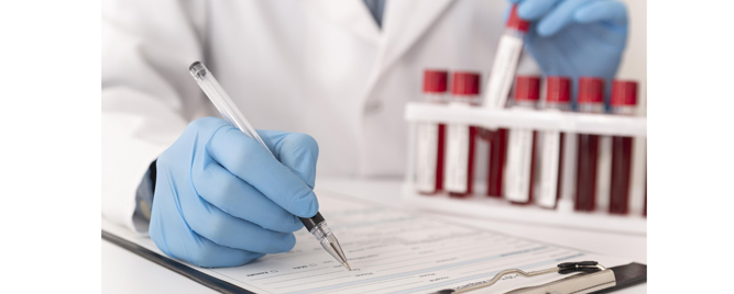 Jednostavan biomarker za prognozu akutnog miokarditisa