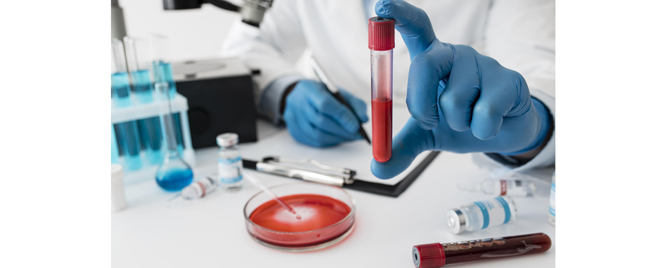 Neinvazivni skrining kolorektalnog karcinoma – jednostavan test iz krvi