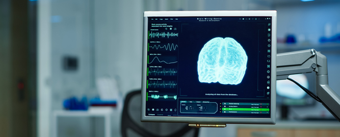 Sentinel sistem za cerebralnu protekciju tokom TAVI: šta pokazuje nova meta-analiza?