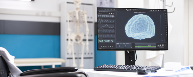 Parkinsonova bolest, Gošeova bolest i ekspektorans: šta ih povezuje?