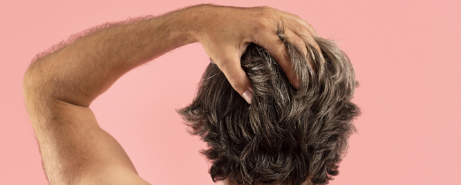 Oralni minoksidil za terapiju alopecije – strah od tahikardije