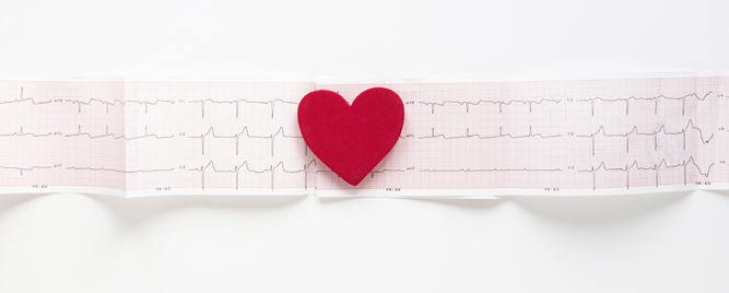 Nova atrijalna fibrilacija nakon CABG češća nego što se očekuje
