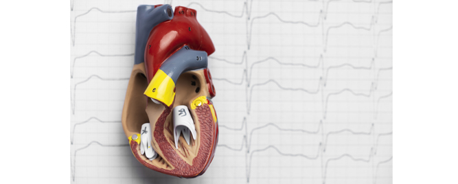 TAVI vs. hirurgija kod niskorizičnih pacijenata: sedam godina kasnije