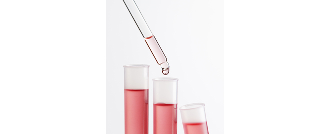 Skrining familijarne hipergholesterolemije kod novorođenčadi: šta je uočeno?