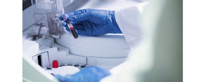 Nalaz tireoidnih TPO antitela i kardiovaskularni rizik