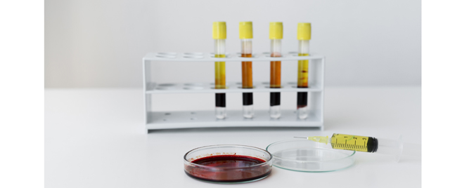 Novi lek testiran kod pacijenata sa homozigotnom familijarnom hiperholesterolemijom