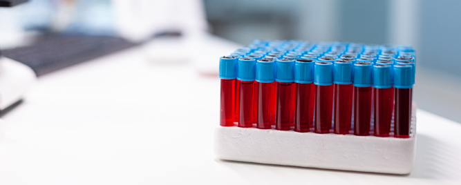 Kardiovaskularni rizik kod zdravih žena: uloga Lp(a)