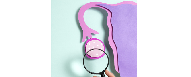 Oportunistička salpingektomija kao savremena strategija prevencije karcinoma jajnika