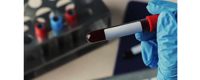 Asundexian: antikoagulantni efekat bez povećanja rizika od krvarenja