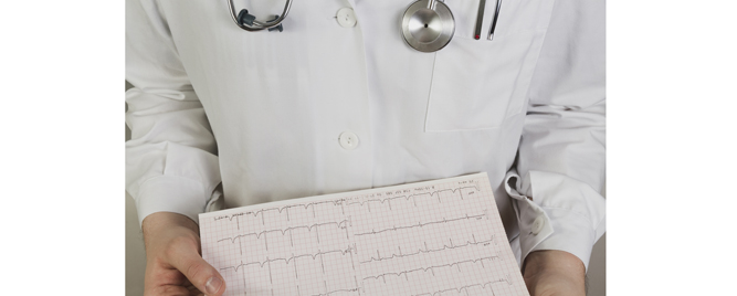 Akutni infarkt miokarda komplikovan kardiogenim šokom – da li je bezbedna intravenska antitrombocitna terapija?