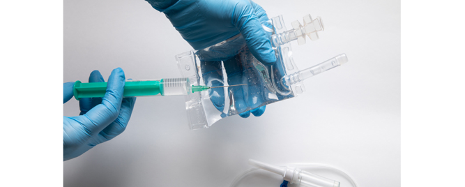 Biološka terapija za lupus nefritis efikasna i kod aktivne forme SLE