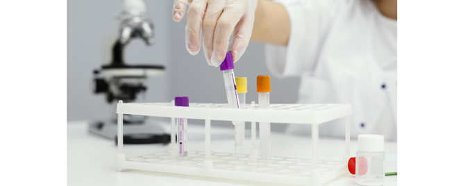 Trombocitopenija indukovana hemioterapijom: romiplostim daje obećavajuće rezultate