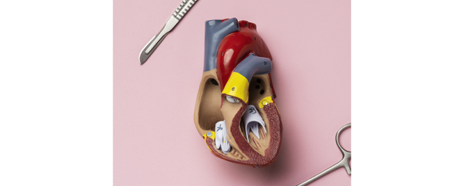 Rano hirurško lečenje asimptomatske aortne stenoze – 10 godina kasnije