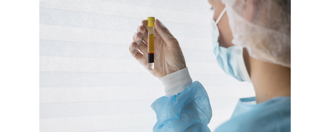 Evolokumab za dijabetičare koji ne znaju da imaju aterosklerozu, ali je LDL povišen