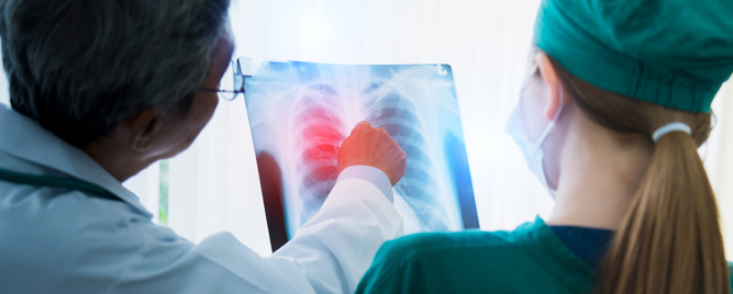 VATS vs. otvorena hirurgija u lečenju karcinoma pluća: rezultati nove meta-analize