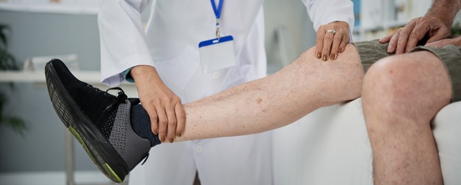 Endovaskularno lečenje posttrombotskog sindroma – da li pomaže?