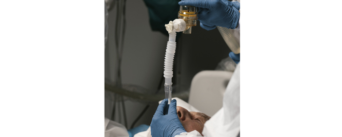 Indukcija anestezije kod hitne endotrahealne intubacije kritičnih bolesnika: ketamin ili etomidat?