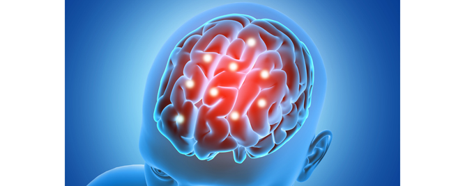 Protektivni efekat karotidne revaskularizacije na pojavu epilepsije