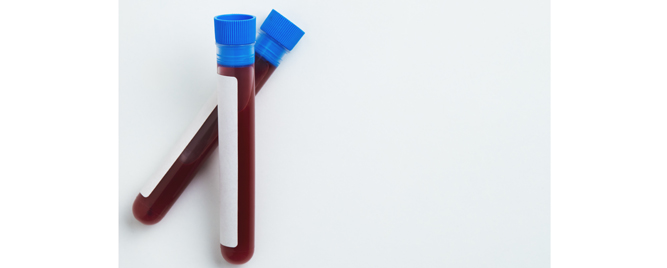 Obustavljanje levotiroksina kod osoba starijih od 60 godina: može, ali oprezno