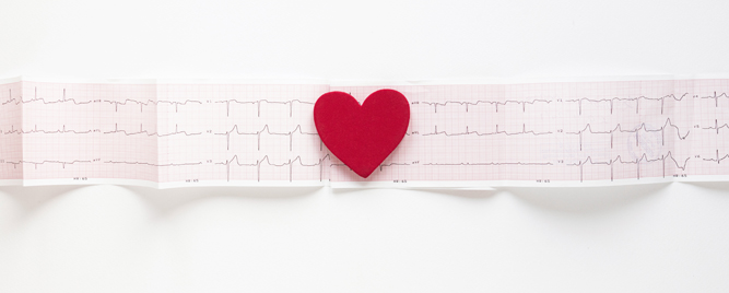 Ablacija pulsnim poljem kao prva terapijska opcija kod perzistentne AF