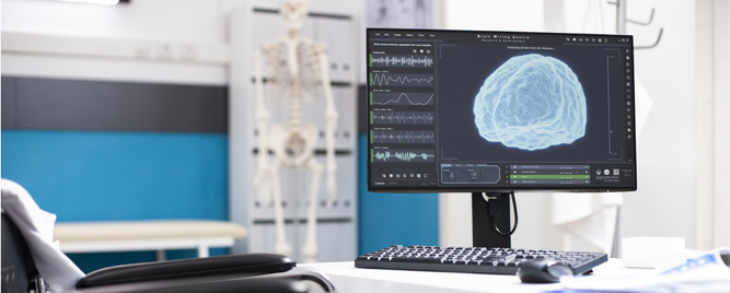 Bazilarna okluzija: kada dodatna tromboliza ne menja ishod