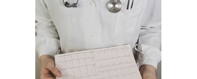 Samo mesec dana dvojne antitrombotske terapije nakon PCI kod AF? OPTIMA-AF donosi odgovor