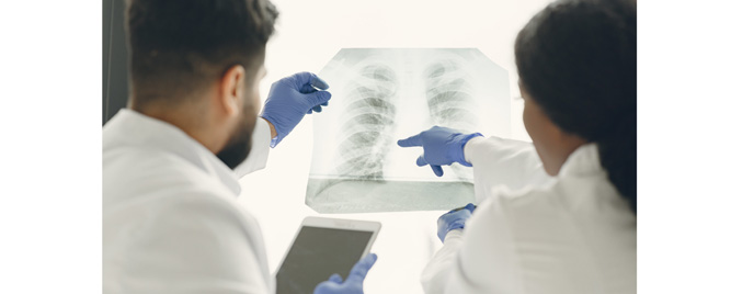Ralinepag smanjuje rizik od kliničkog pogoršanja plućne arterijske hipertenzije za 55%
