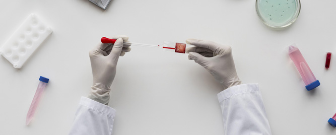 Kardiovaskularna inflamacija posredstvom interleukina-6: izostao klinički efekat